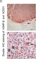 Immunohistochemistry: GMF-beta Antibody [NBP1-89755] - GMF-beta  knockdown suppresses tumor growth & the formation of human-CD31 positive microvessels (hCD31-MVs) in orthotopic U87 xenograft modelsA. The cross-sectional appearance of xenografted gliomas from U87-mock group B. The cross-sectional appearance of xenografted gliomas from U87-shGMF-beta  group. Gross tumor boundaries were delineated by white dotlines. C. A hCD31-microvessel & several hCD31-negative vessels in U87-mock tumor. D. No hCD31-MVs, only hCD31-negative vessels in U87-shGMF-beta  tumor. Red solid arrows indicate hGMF-beta  staining in tumor cells, black solid arrows show hCD31 staining on microvasular endothelia, & open arrows denote vessels negative for hCD31. Scale bar: 100 μm in upper pannels; 50 μm in lower pannels. E. Quantitative comparisons of gross tumor volume between U87-mock & U87-shGMF-beta  group. F. Quantitative comparisons of hCD31-microvessel densities (MVDs) between U87-mock & U87-shGMF-beta  group. Image collected & cropped by CiteAb from the following publication (//pubmed.ncbi.nlm.nih.gov/26515590), licensed under a CC-BY license. Not internally tested by Novus Biologicals.