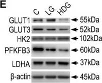 High glucose-induced premature senescent HRMECs exhibit diminished glycolysis. (A) Gene Set Enrichment Analysis for Glycolysis gene signature. Transcriptome data from bulk RNA sequencing of three biological replicates of HRMECs cultured with 25 mM D-glucose vs. the 5 mM control at 4 weeks of culture. Gene signature from KEGG Glycolysis was used for the gene set enrichment analysis (GSEA). Heatmaps below depict the leading edges for transcripts responsible for major differences. NES: Normalized Enrichment Score. p adj: adjusted p value. (B) Energy phenotype plot from Seahorse XFe96 analyzer depicting assessment of glycolysis as extracellular acidification rate (ECAR) and mitochondrial respiration as oxygen consumption rate (OCR) at baseline and stressed phenotypes. (C) Glycolysis stress assay to characterize glycolysis in HRMECs under different culture conditions. Injections in the assay were glucose at 20 min, oligomycin at 40 min, and 2-DG at 60 min. (D) Statistical comparison of basal glycolysis measures using Seahorse Glycolysis stress assay in three biological replicates. (E) Western blot analysis to compare expression of glycolysis-related proteins.  beta -actin was used as the loading control. *p < 0.05, ns: not significant. One-way ANOVA, with Tukey’s post-hoc analysis was used. C, control in blue; LG in green, 25 mM (+L-glucose); HDG in red, 25 mM (+D-glucose). Image collected and cropped by CiteAb from the following open publication (//pubmed.ncbi.nlm.nih.gov/36091370), licensed under a CC-BY license. Not internally tested by Novus Biologicals.