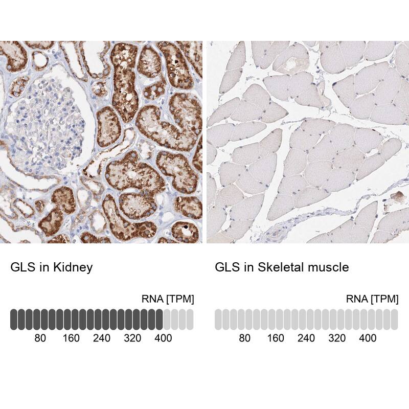 Analysis in human kidney and skeletal muscle tissues. Corresponding RNA-seq data are presented for the same tissues.
