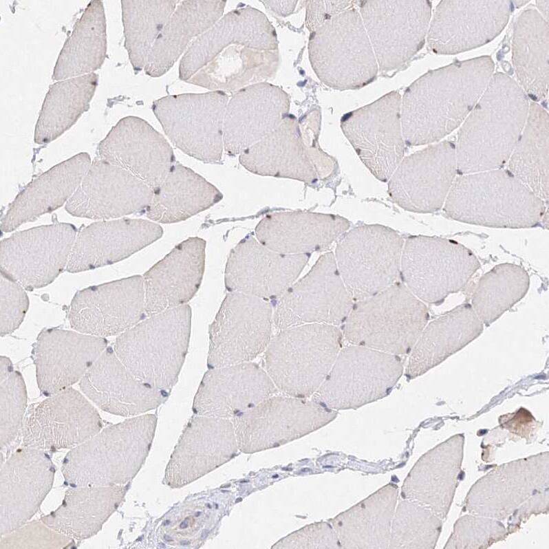 Staining of human skeletal muscle shows no positivity in myocytes as expected.