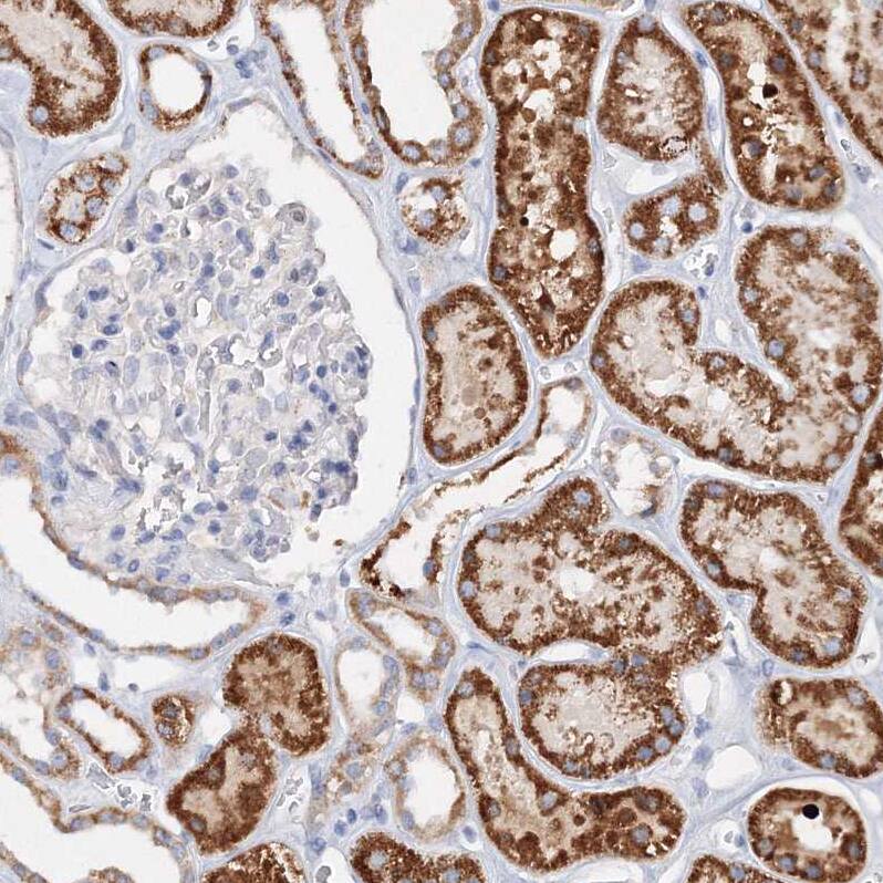 Staining of human kidney shows strong granular cytoplasmic positivity in cells in tubules.