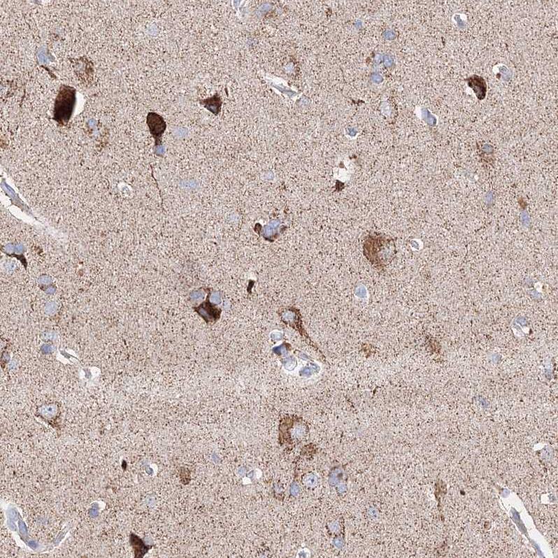 Staining of human cerebral cortex shows moderate to strong granular cytoplasmic positivity in neurons.