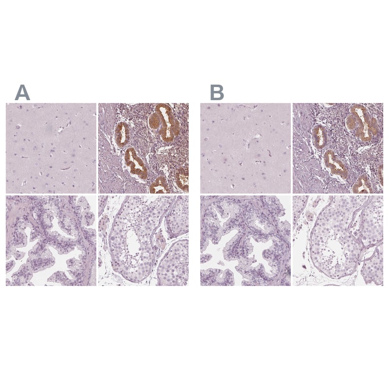 <b>Orthogonal Strategies Validation. </b>Staining of human cerebral cortex, endometrium, prostate and testis HPA029473 (A) shows similar protein distribution across tissues to independent antibody HPA020108 (B).