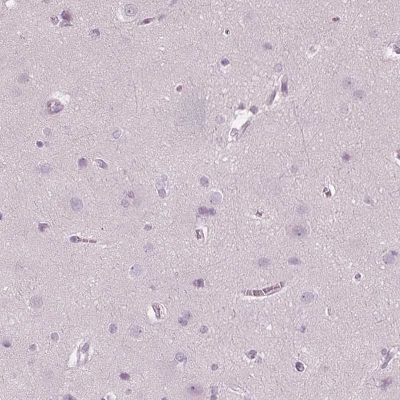 Immunohistochemistry-Paraffin PP14/Glycodelin Antibody - BSA Free