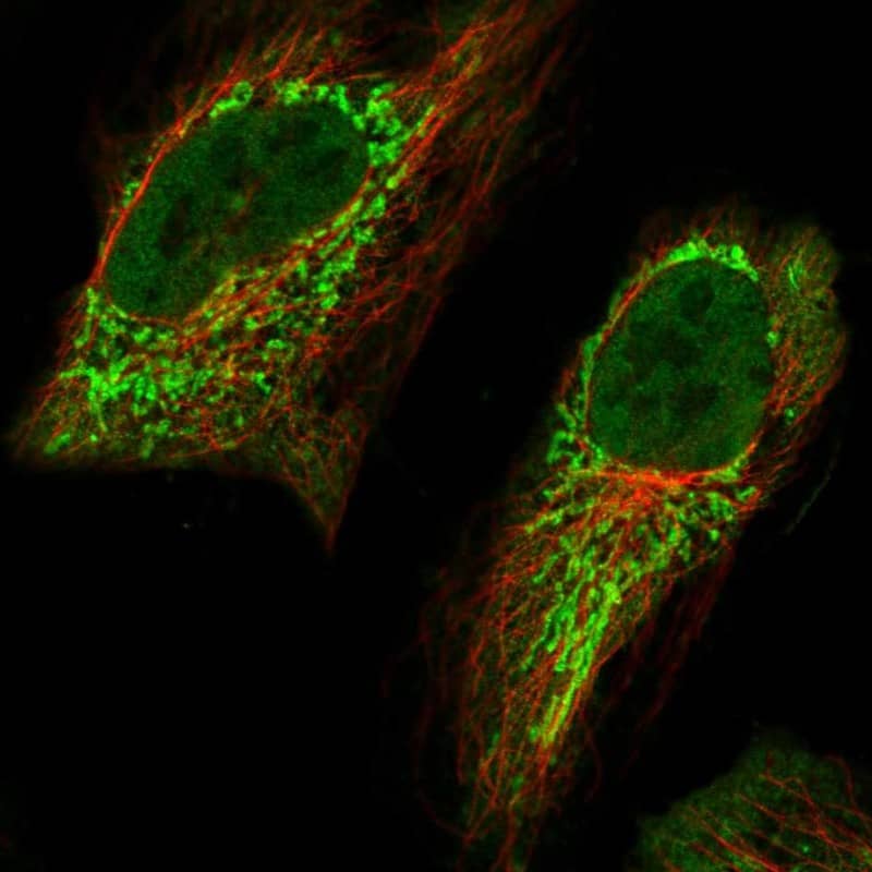 Immunocytochemistry/ Immunofluorescence Aminomethyltransferase Antibody - BSA Free