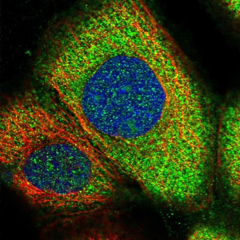 Staining of human cell line A-431 shows localization to cytosol.