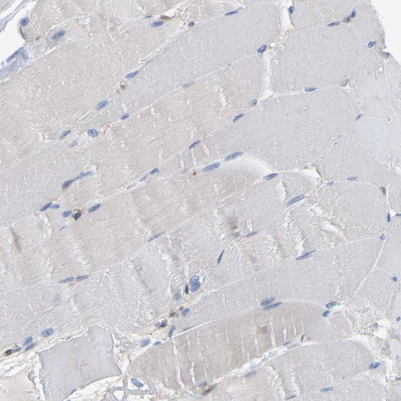 Staining of human skeletal muscle shows no positivity in myocytes as expected.