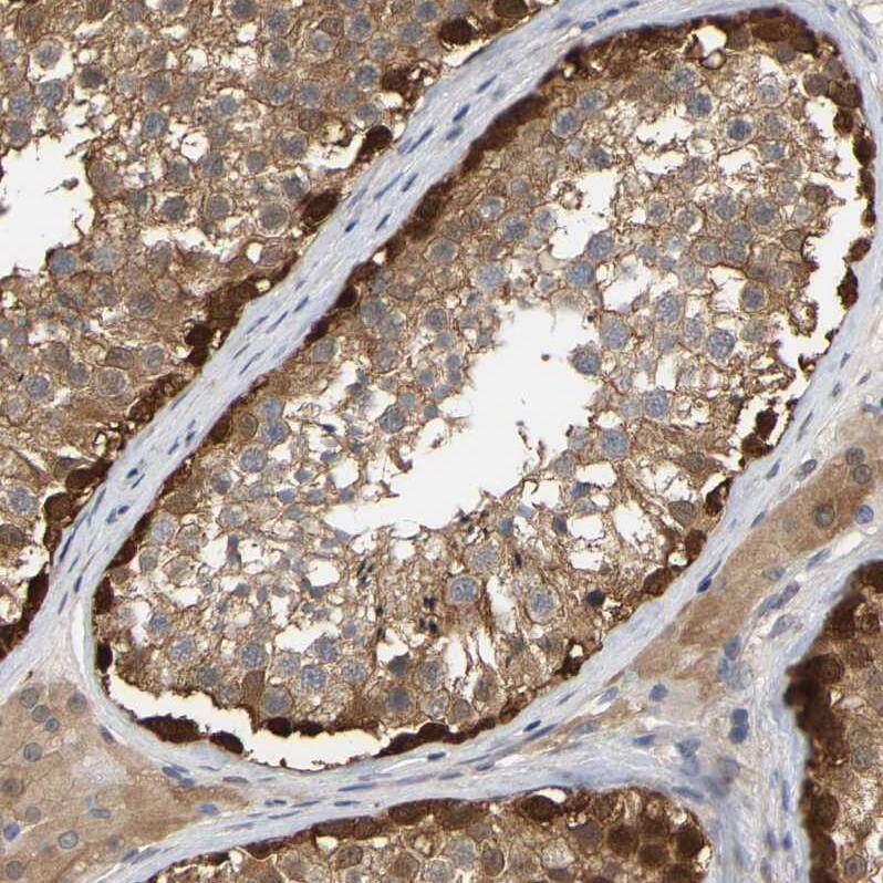 Staining of human testis shows moderate to strong cytoplasmic positivity in cells in seminiferous ducts.