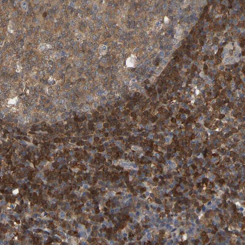 Staining of human tonsil shows strong cytoplasmic positivity in non-germinal center cells.