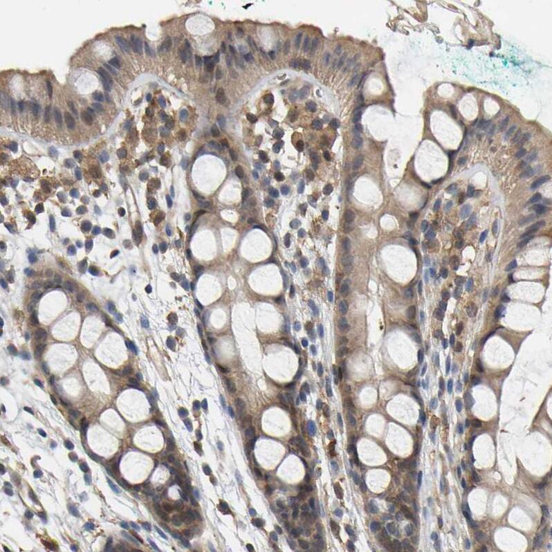 Staining of human rectum shows moderate cytoplasmic positivity in glandular cells.
