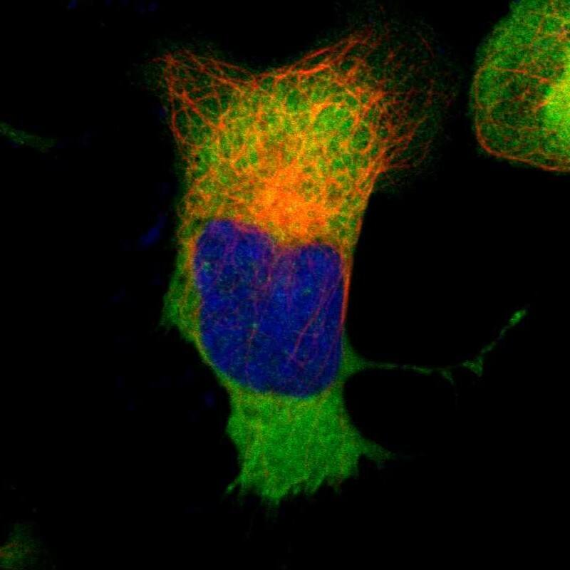 Immunocytochemistry/ Immunofluorescence Glucose 6 Phosphate Dehydrogenase Antibody - BSA Free