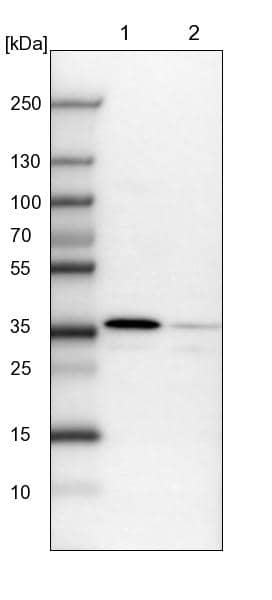 Lane 1: NIH-3T3 cell lysate (Mouse embryonic fibroblast cells)Lane 2: NBT-II cell lysate (Rat Wistar bladder tumour cells)