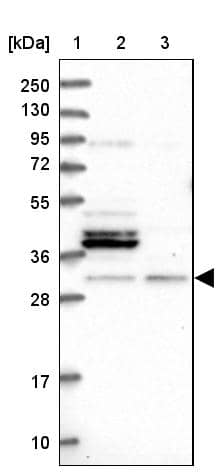 Lane 1: Marker [kDa] 250, 130, 95, 72, 55, 36, 28, 17, 10Lane 2: Human cell line RT-4Lane 3: Human cell line U-251MG sp
