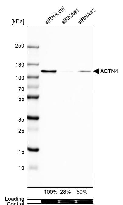 <b>Genetic Strategies Validation. </b>Analysis in A-549 cells transfected with control siRNA, target specific siRNA probe #1 and #2, using Anti-ACTN4 antibody. Remaining relative intensity is presented. Loading control: Anti-GAPDH.