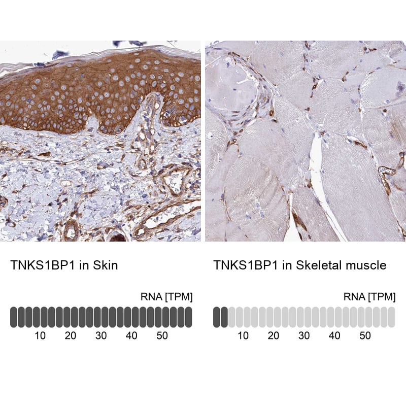 <b>Independent Antibodies Validation and Orthogonal Strategies Validation.</b>Analysis in human skin and skeletal muscle tissues using Anti-TNKS1BP1 antibody. Corresponding TNKS1BP1 RNA-seq data are presented for the same tissues.