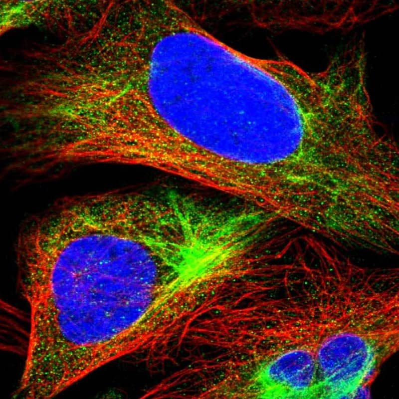 Immunocytochemistry/ Immunofluorescence Mucolipin 2 Antibody - BSA Free