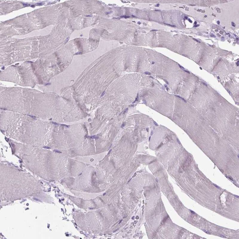 Immunohistochemistry-Paraffin MARCH10 Antibody - BSA Free