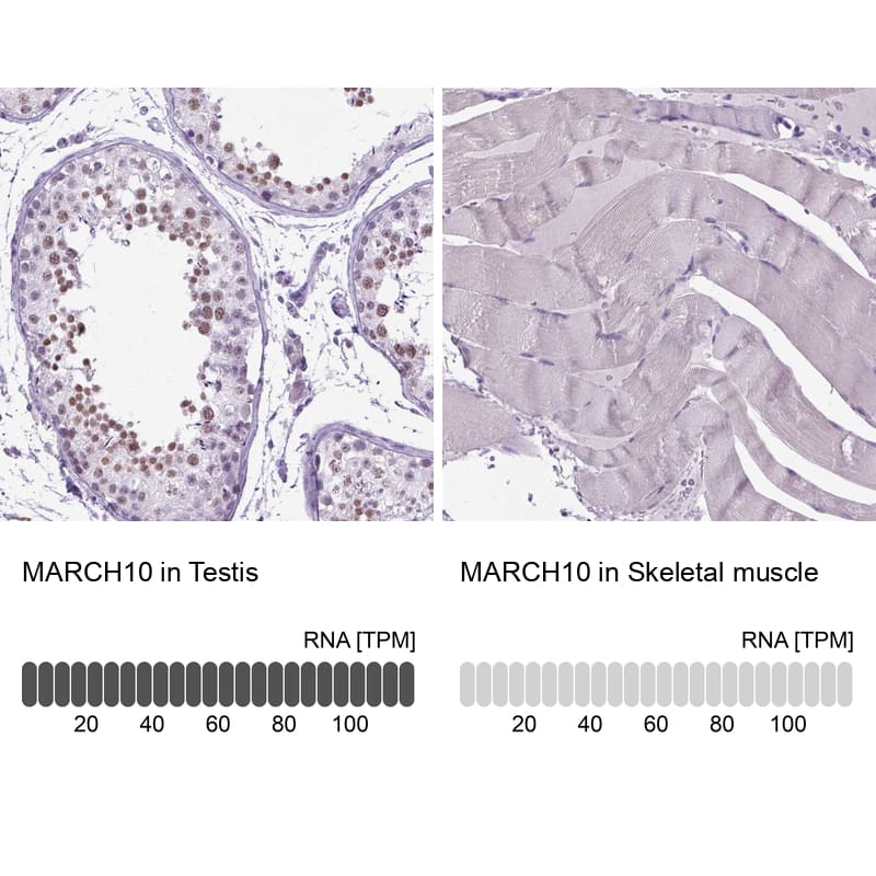 Immunohistochemistry-Paraffin MARCH10 Antibody - BSA Free