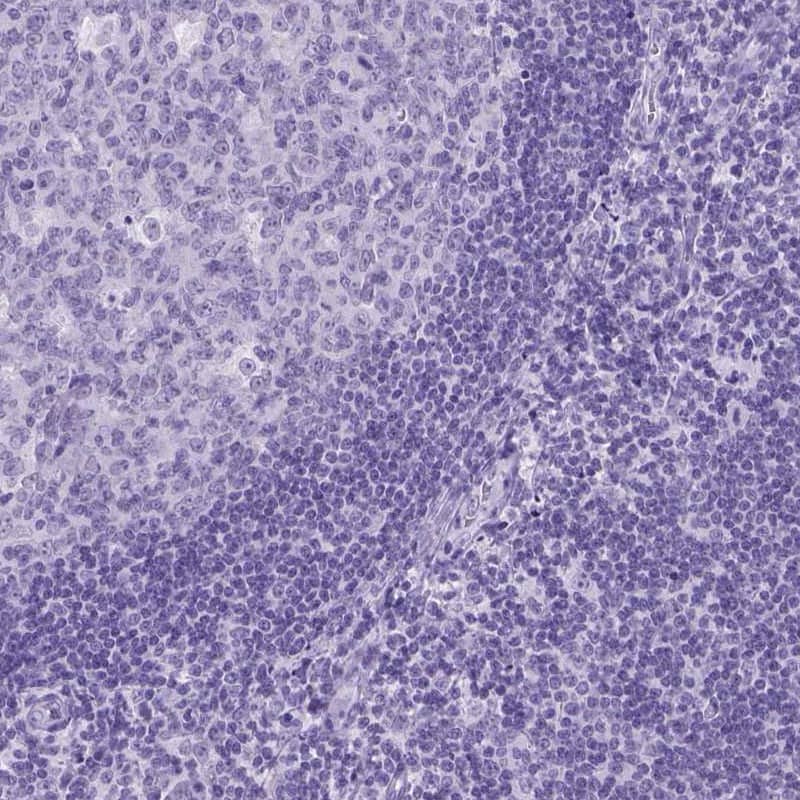 Immunohistochemistry-Paraffin MARCH10 Antibody - BSA Free
