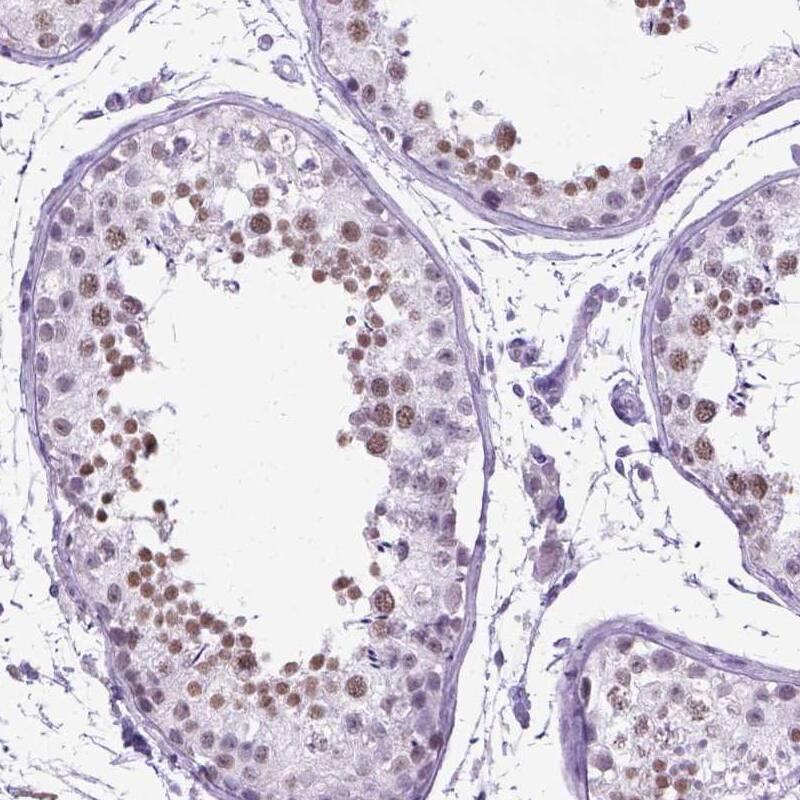 Immunohistochemistry-Paraffin MARCH10 Antibody - BSA Free