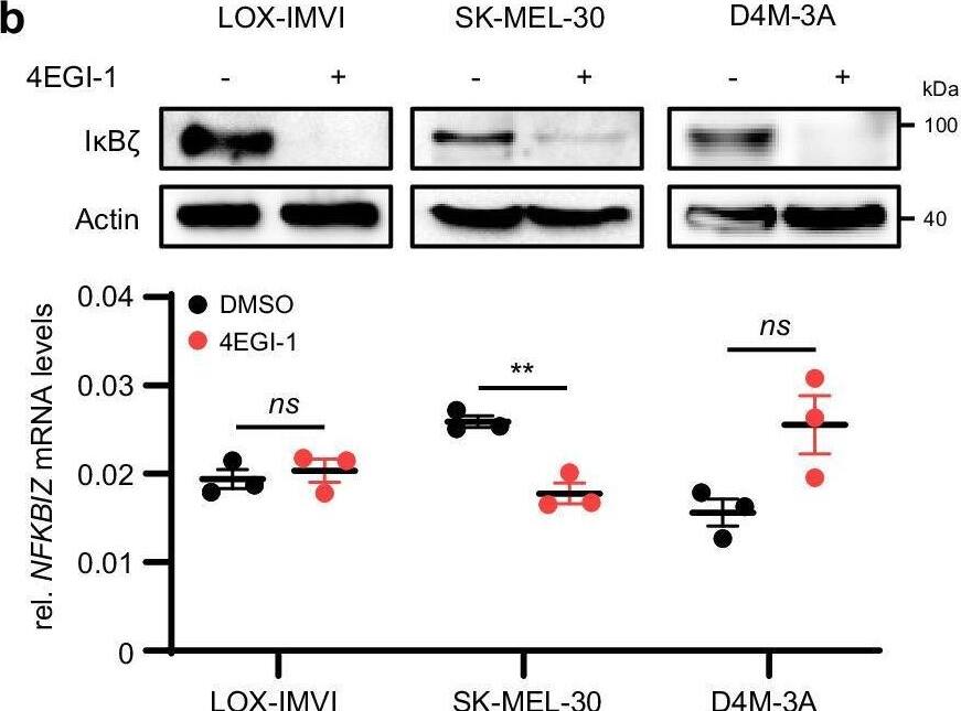 I kappa B zeta  protein is constitutively expressed in a subgroup of melanoma cell lines and melanoma patients.a–c  beta -Actin serves as a loading control for immunoblot detection of I kappa B zeta . Human NFKBIZ mRNA expression levels were normalized to RPL37A, and murine Nfkbiz mRNA expression to Actb, respectively. Shown is the mean of 3 independent experiments +/- standard deviation (SD). Significance was calculated using a two-tailed Student’s t-test (**p < 0.01, ns = not significant). a I kappa B zeta  expression levels in various human and murine melanoma cell lines at steady state (Top: immunoblot detection, bottom: mRNA levels). b Detection of I kappa B zeta  (NFKBIZ) levels 24 h after treatment with 25 uM 4EGI-1 or a DMSO vehicle control. c I kappa B zeta  expression levels 4 h after treatment with 10 uM MG-132 or a DMSO vehicle control. d Relative amount of I kappa B zeta -positive melanoma samples as detected by immunohistochemical staining of FFPE samples. Top: Analysis of I kappa B zeta  protein expression in 90 metastatic melanoma patients using a commercial skin tissue array. Bottom: Representative pictures showing no expression of I kappa B zeta , or moderate and high expression of I kappa B zeta  in melanoma. Scale bar: 100 um. e Kaplan-Meier curve showing the progression-free survival (PFS) of 54 melanoma patients grouped according to the presence or absence of tumor-derived I kappa B zeta  protein expression. Shown is the median +/- 95% CI. Significance was calculated using a two-tailed Student’s t-test (*p < 0.05, **p < 0.01, and ***p < 0.001). Survival analyses were conducted using the survminer R package (RStudio Version 1.3.1093). Source data and exact P values are provided in the Source Data file. Image collected and cropped by CiteAb from the following open publication (//pubmed.ncbi.nlm.nih.gov/40562773), licensed under a CC-BY license. Not internally tested by Novus Biologicals.
