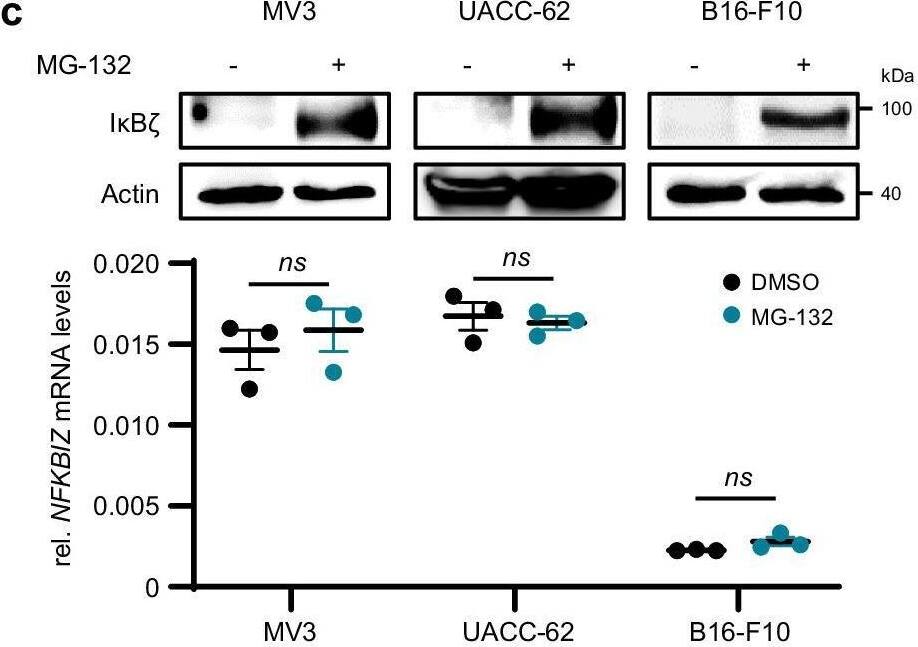 I kappa B zeta  protein is constitutively expressed in a subgroup of melanoma cell lines and melanoma patients.a–c  beta -Actin serves as a loading control for immunoblot detection of I kappa B zeta . Human NFKBIZ mRNA expression levels were normalized to RPL37A, and murine Nfkbiz mRNA expression to Actb, respectively. Shown is the mean of 3 independent experiments +/- standard deviation (SD). Significance was calculated using a two-tailed Student’s t-test (**p < 0.01, ns = not significant). a I kappa B zeta  expression levels in various human and murine melanoma cell lines at steady state (Top: immunoblot detection, bottom: mRNA levels). b Detection of I kappa B zeta  (NFKBIZ) levels 24 h after treatment with 25 uM 4EGI-1 or a DMSO vehicle control. c I kappa B zeta  expression levels 4 h after treatment with 10 uM MG-132 or a DMSO vehicle control. d Relative amount of I kappa B zeta -positive melanoma samples as detected by immunohistochemical staining of FFPE samples. Top: Analysis of I kappa B zeta  protein expression in 90 metastatic melanoma patients using a commercial skin tissue array. Bottom: Representative pictures showing no expression of I kappa B zeta , or moderate and high expression of I kappa B zeta  in melanoma. Scale bar: 100 um. e Kaplan-Meier curve showing the progression-free survival (PFS) of 54 melanoma patients grouped according to the presence or absence of tumor-derived I kappa B zeta  protein expression. Shown is the median +/- 95% CI. Significance was calculated using a two-tailed Student’s t-test (*p < 0.05, **p < 0.01, and ***p < 0.001). Survival analyses were conducted using the survminer R package (RStudio Version 1.3.1093). Source data and exact P values are provided in the Source Data file. Image collected and cropped by CiteAb from the following open publication (//pubmed.ncbi.nlm.nih.gov/40562773), licensed under a CC-BY license. Not internally tested by Novus Biologicals.
