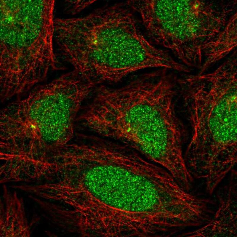 Staining of human cell line SiHa shows localization to nucleus, nucleoli fibrillar center & centrosome.