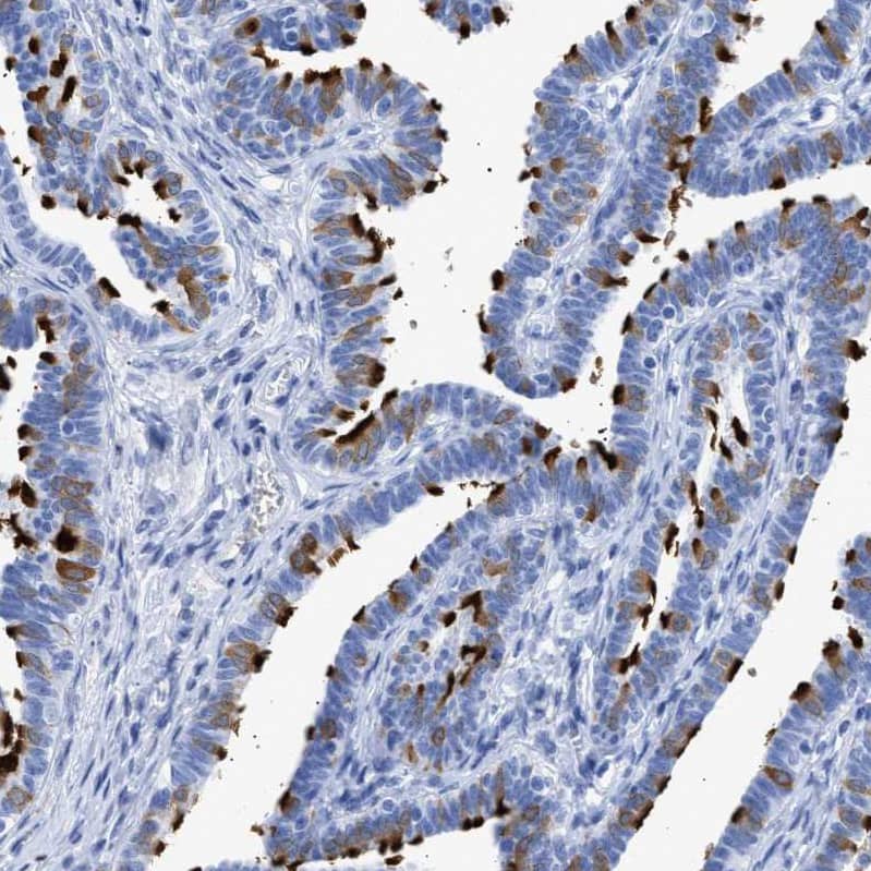 Immunohistochemistry-Paraffin TSGA2 Antibody - BSA Free