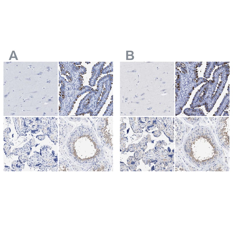 Immunohistochemistry-Paraffin TSGA2 Antibody - BSA Free