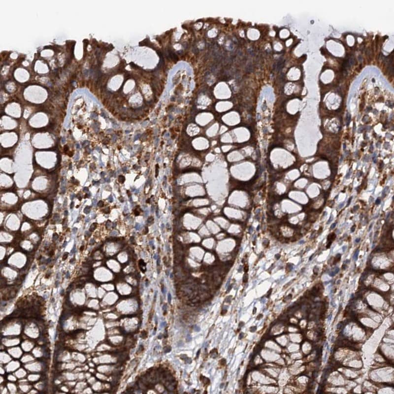 <b>Independent Antibodies Validation. </b>Staining of human colon shows strong cytoplasmic positivity in glandular cells.