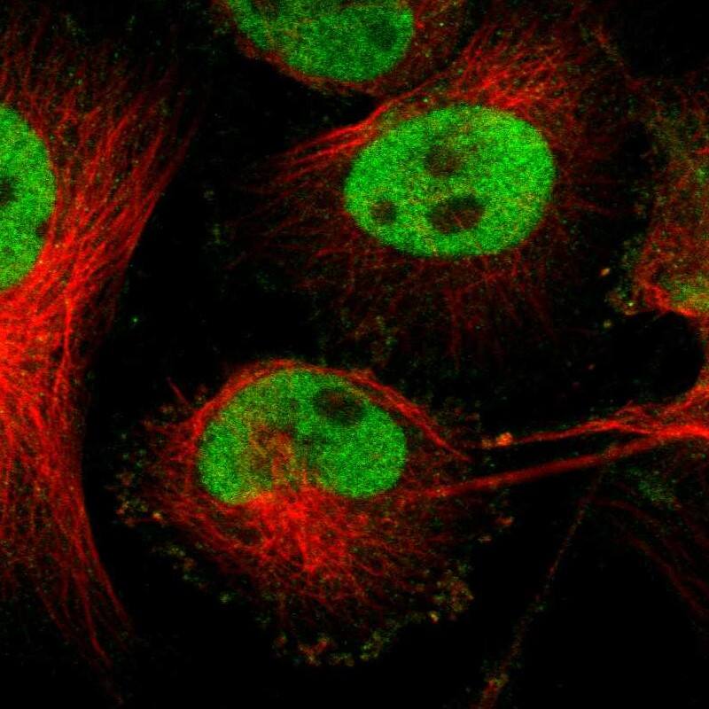 Staining of human cell line U-251 MG shows localization to nucleoplasm.