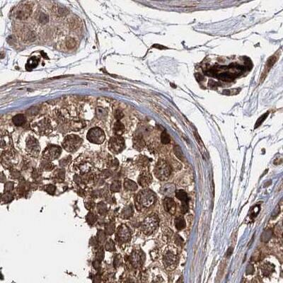 <b>Independent Antibodies Validation. </b>Staining of human testis.