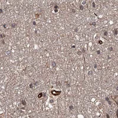 Staining of human cerebral cortex.