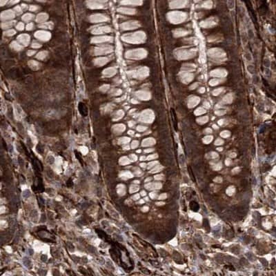 Staining of human colon.
