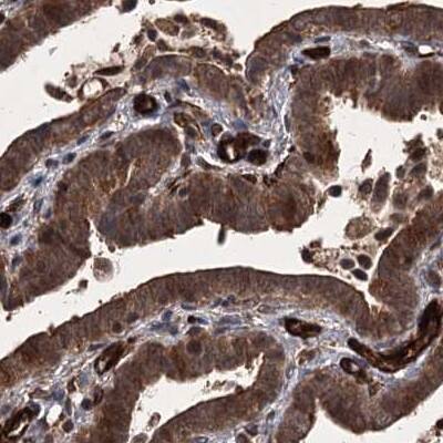 Staining of human fallopian tube.