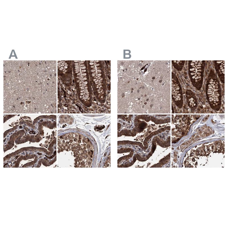 <b>Orthogonal Strategies Validation. </b>Staining of human cerebral cortex, colon, fallopian tube and testis HPA038312 (A) shows similar protein distribution across tissues to independent antibody HPA038311 (B).