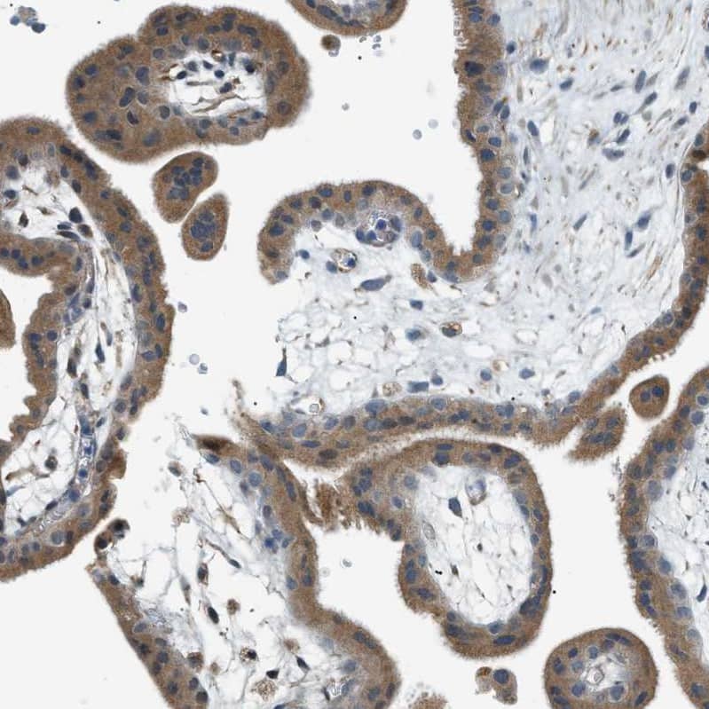 Staining of human placenta shows moderate cytoplasmic positivity in trophoblastic cells.