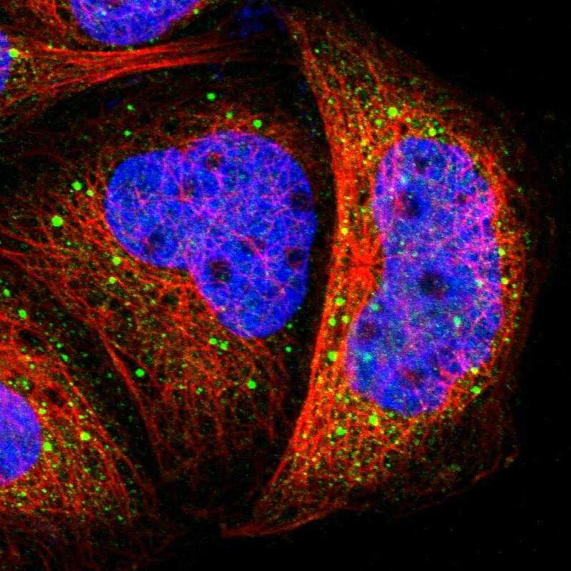 Staining of human cell line A-431 shows localization to vesicles.