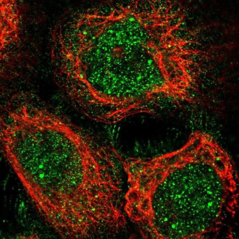 Staining of human cell line A-431 shows localization to nucleoplasm, nuclear bodies, plasma membrane & cytosol.