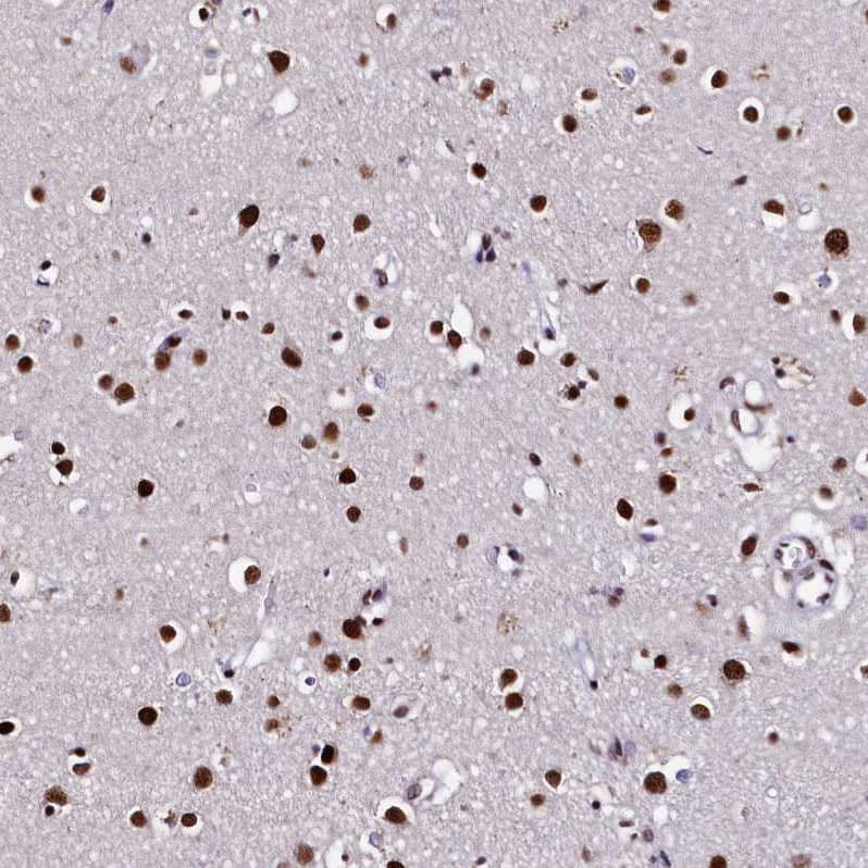 Staining of human cerebral cortex shows strong nuclear positivity in neurons.