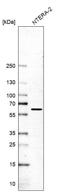 Analysis in human cell line NTERA-2.