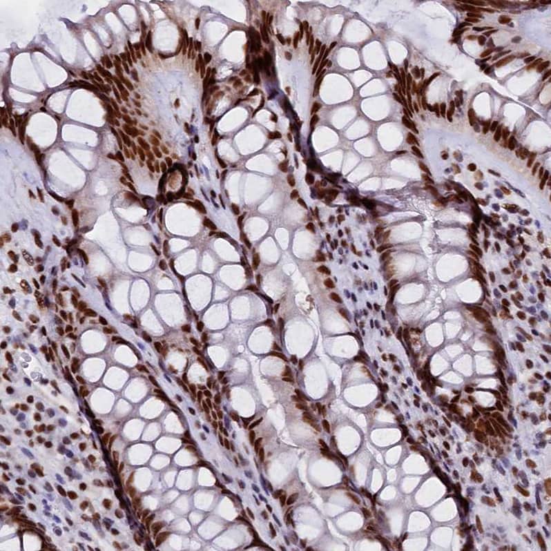 Staining of human rectum shows strong nuclear positivity in glandular cells.