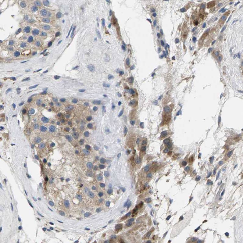 Immunohistochemistry-Paraffin ERGI3 Antibody - BSA Free