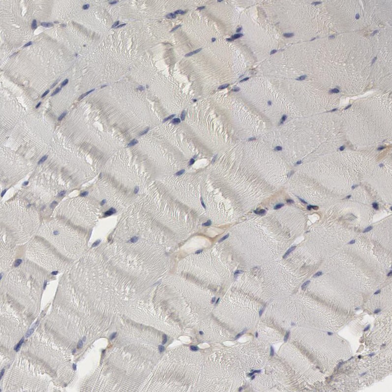 Immunohistochemistry-Paraffin Complement Component C1qC Antibody - BSA Free
