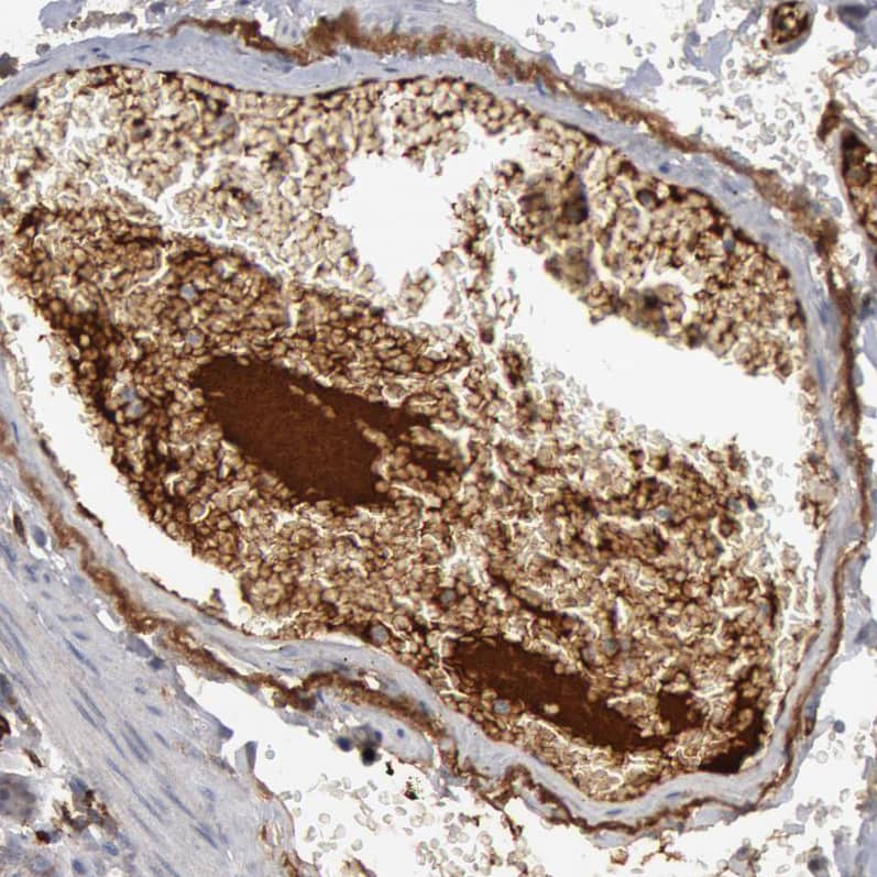 Immunohistochemistry-Paraffin Complement Component C1qC Antibody - BSA Free