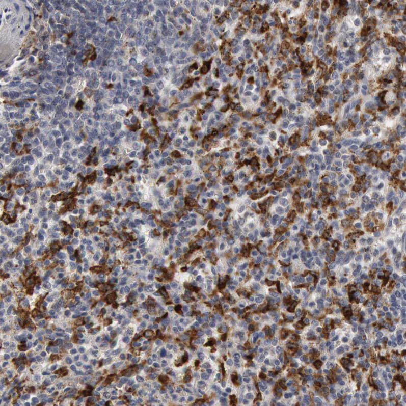 Staining of human spleen shows strong cytoplasmic positivity in cells in red pulp.