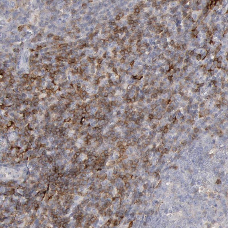 Staining of human lymphoid tissues shows moderate cytoplasmic positivity in non-germinal center cells.