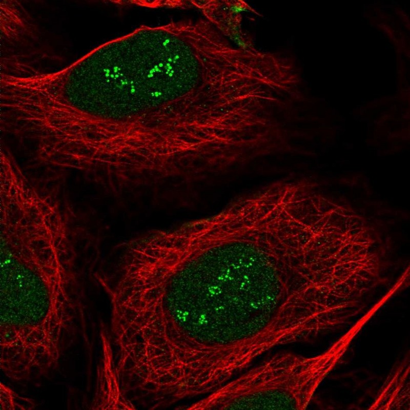 Immunocytochemistry/ Immunofluorescence sen15 Antibody - BSA Free