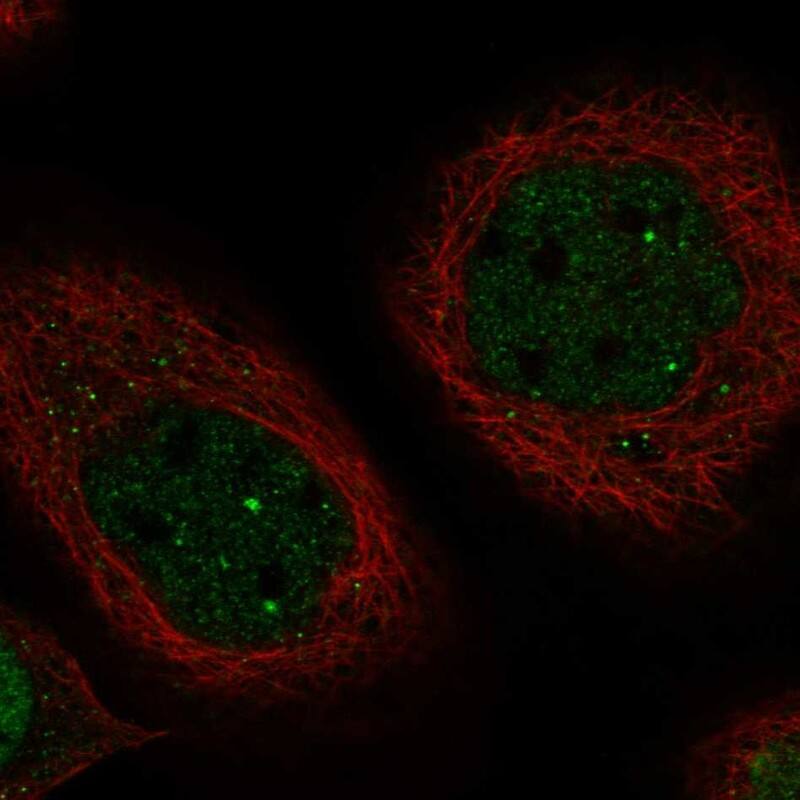 Immunocytochemistry/ Immunofluorescence MTAC2D1 Antibody - BSA Free