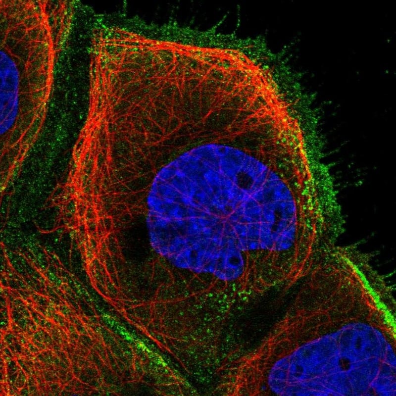 Staining of human cell line A-431 shows localization to plasma membrane.